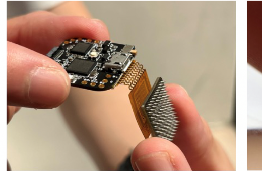 HKU Engineering team develops next-generation wearable continuous glucose monitoring system for diabetes management